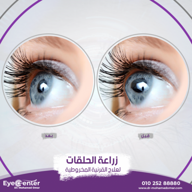 Dr. Mohamed Omar Eye Clinic